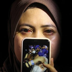 Kondisi mata Diby Fadilah di Gresik. Dia menunjukkan foto selfie-nya di ponsel saat berada di Stadion Kanjuruhan, Kabupaten Malang, sebelum laga Arema FC vs Persebaya Surabaya dimulai. (GUSLAN GUMILANG/JAWA POS)